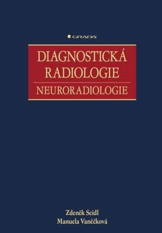 Diagnostická radiologie - Zdeněk Seidl, Manuela Vaněčková - e-kniha