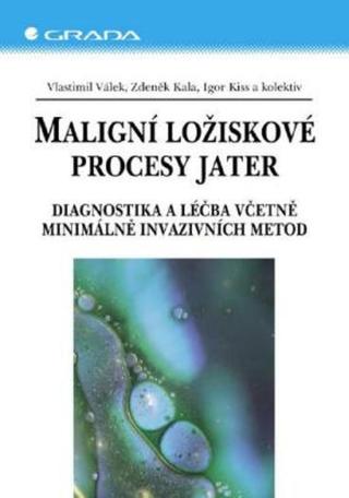 Maligní ložiskové procesy jater - Zdeněk Kala, Igor Kiss, Vlastimil Válek - e-kniha