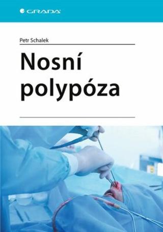 Nosní polypóza - Petr Schalek - e-kniha