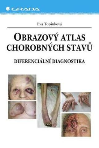 Obrazový atlas chorobných stavů - Eva Topinková - e-kniha