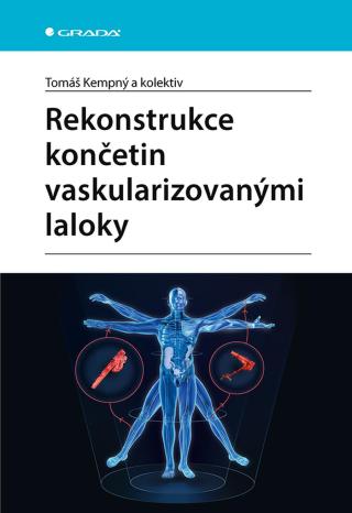 Rekonstrukce končetin vaskularizovanými laloky, Kempný Tomáš