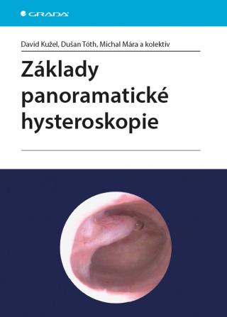 Základy panoramatické hysteroskopie, Kužel David